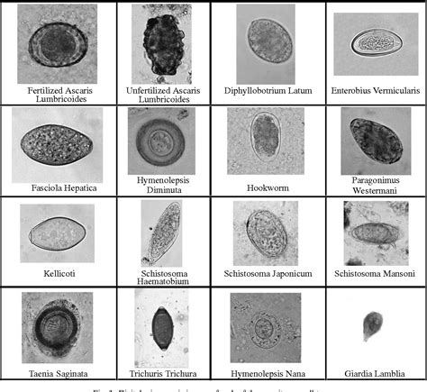 Microscopic Intestinal Parasites In Humans