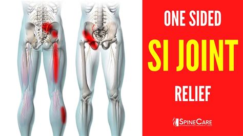 How To Fix Sacroiliac Joint Pain Off To One Side Youtube
