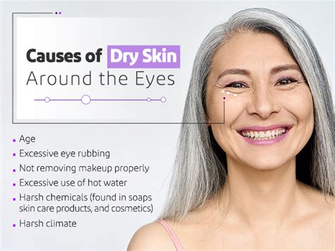 Dry Skin Around Eyes Causes And Treatments