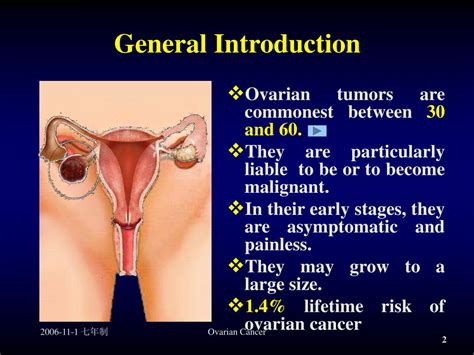 Ppt Ovarian Cancer Powerpoint Presentation Free Download Id968652