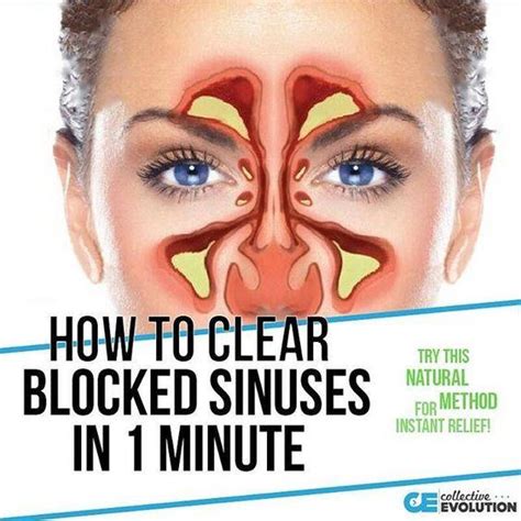 How To Clear Seriously Blocked Sinuses Naturally In 1 Minute With This Massage — Info You Should