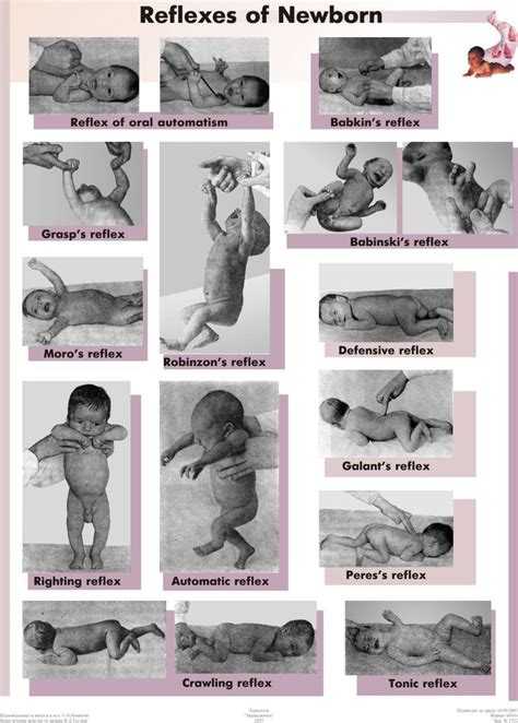 Primitive Reflexes With Images Primitive Reflexes Pediatric