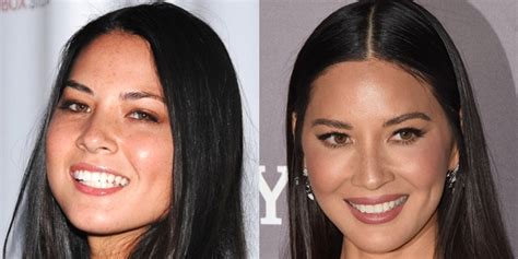 How Olivia Munn Lost Her Freckles Face Before And After