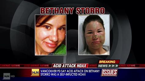 Police Washington State Woman Made Up Acid Attack Story
