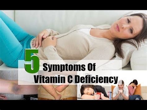 Top Symptoms Of Vitamin C Deficiency Youtube