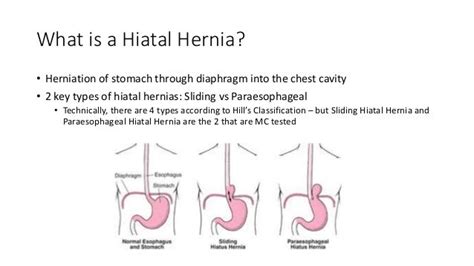 Hiatal Hernias