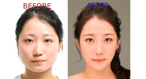 Plastic Surgery Is Actually A Very Common Korean T