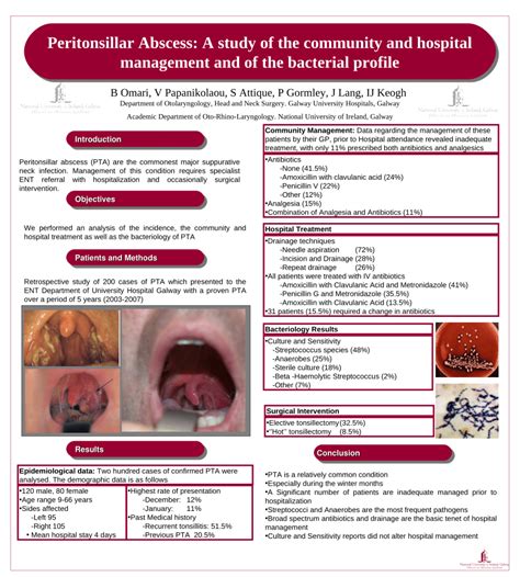 Peritonsillar Abscess Anatomy