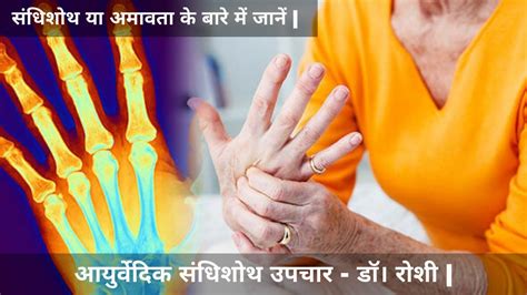 Learn About Rheumatoid Arthritis Or Amavata Rheumatoid Arthritis