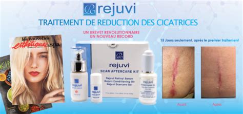 Une formation de barbier sans cap de coiffure est elle possible ? produits formations plasma pen, hyaluron pen, microneedling