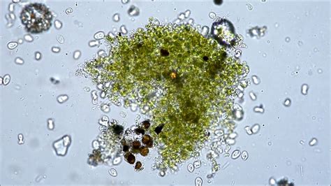 Microorganisms In A Drop Of Water Youtube