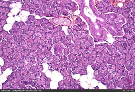 Stock Image Photomicrograph Of A Normal Parotid Gland Histological