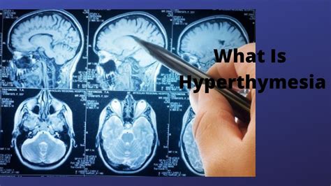 What Is Hyperthymesia YouTube