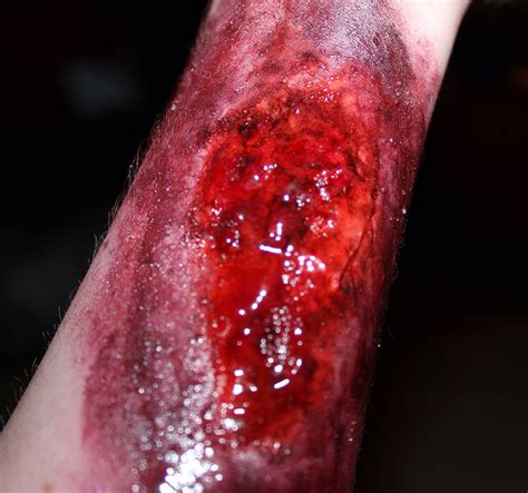 Special effects arm wound/burn | Special effects makeup, Special effects, Special