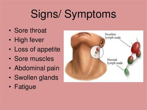 Mononucleosis Homeopathic Treatment By Doctor Tsan In Philadelphia