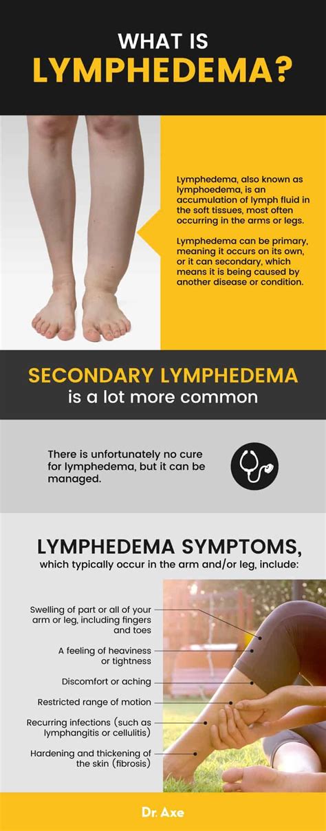 Lymphedema 7 Natural Ways To Manage Symptoms Dr Axe In 2020