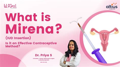 What Mirena IUD Insertion Is It An Effective Contraceptive Method