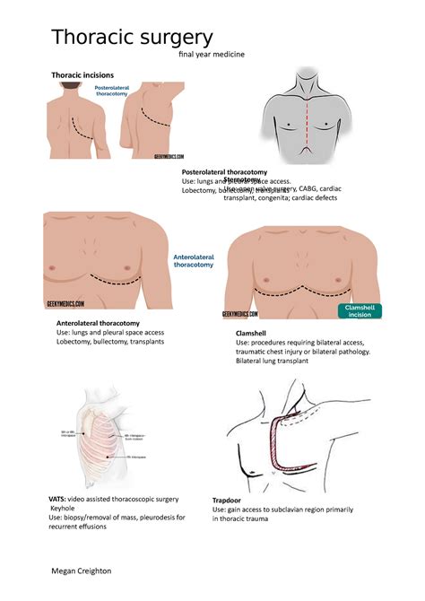 Thoracic Surgery Final Year Medicine Thoracic Incisions Posterolateral Thoracotomy Use Lungs