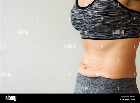 Stretch Marks Concept Hi Res Stock Photography And Images Alamy