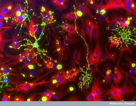 Myelin Facilitation Of Whole Brain Neuroplasticity