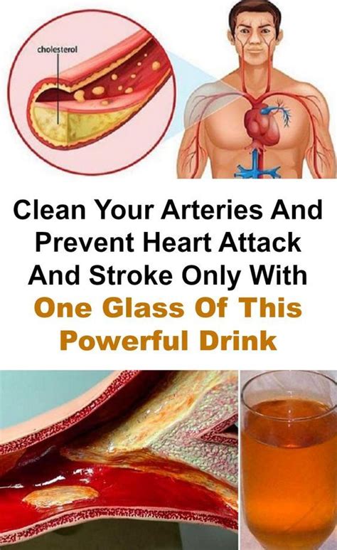 Healthy Beauty Tips For A Healthy Beautiful You Prevent Heart Attack Clean Arteries Artery
