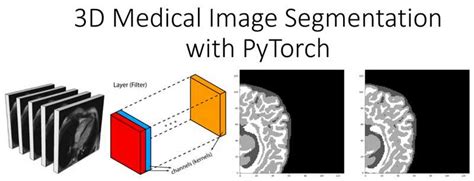 Deep Learning In Medical Imaging D Medical Image Segmentation With