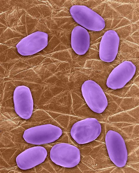 Bacillus Anthracis Spores 1 Photograph By Dennis Kunkel Microscopy