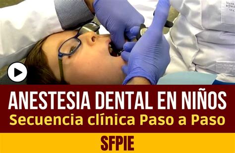 Anestesia Dental En NiÑos Secuencia Clínica Paso A Paso Sfpie