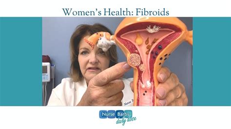 What To Do If You Have Fibroids Youtube