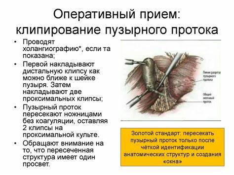 Острый холецистит диеты Острый холецистит. Лапароскопическая холецистэктомия. Холедохолитиаз Острый холецистит. Лапароскопическая холецистэктомия. Холедохолитиаз Острый холецистит диеты