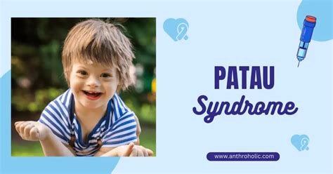 Patau Syndrome Trisomy 13 Anthroholic