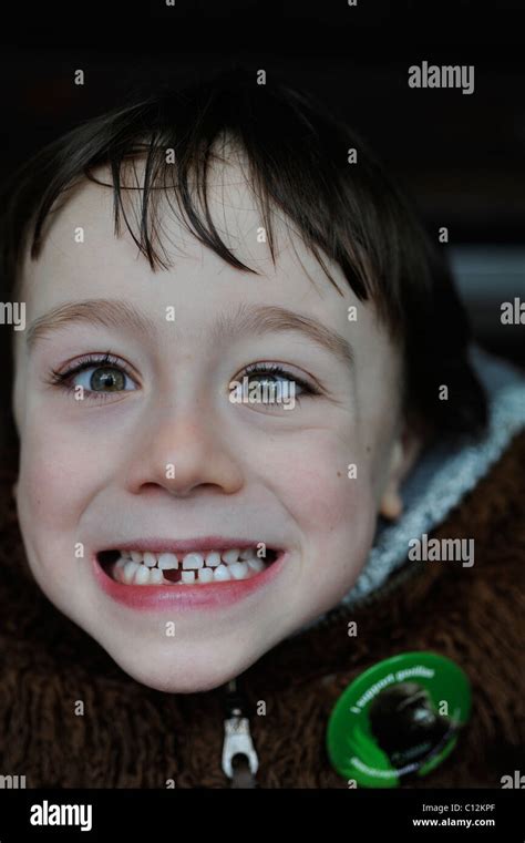 6 Year Old Boy Loses His First Tooth Stock Photo Alamy