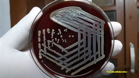 Bacillus Species Colony Morphology On Blood Agar Archives Medical Notes