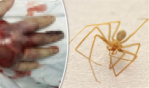 Warning Woman Dies After Being Bitten By Spider Nature News