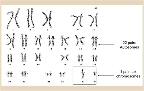 Chromosome Definition Structure And Function Science Shape