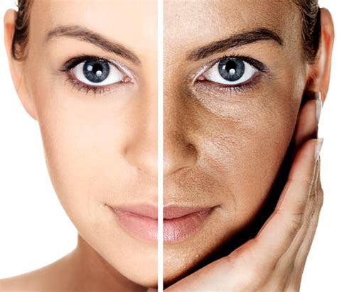 Facial Pigmentation Treatments Your Way Towards A Youthful Skin