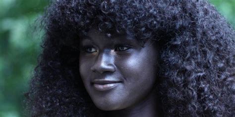 this girl was bullied for her skin color now she s a badass model huffpost life