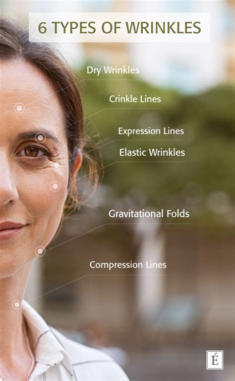 6 Types Of Wrinkles And What To Do About Them For Viral Sake