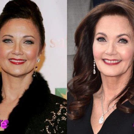 Lynda Carter Before And After Cosmetic Surgery Plastic Surgery Mistakes
