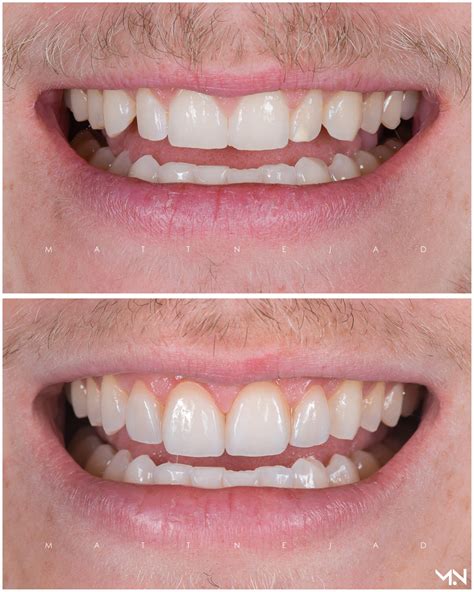 Cosmetic Dentistry Before and After Photos | Helm Nejad Stanley