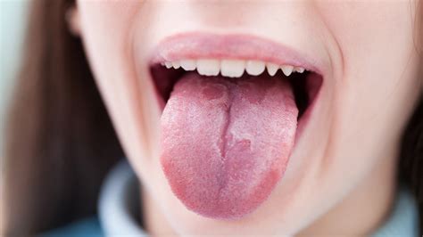 Das Verrät Deine Zunge über Deine Gesundheit Kukksi Star News