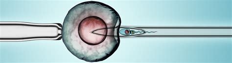 Intracytoplasmic Sperm Injection Icsi Red Rock Fertility Center