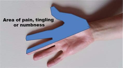 The Sharp Arrow Do You Ever Shake Your Hands To Rid Pain Or Regain