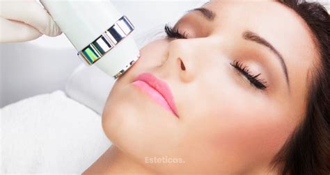 Estética Facial Tipos De Láser Ar