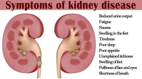 What Happens If You Have Kidney Failure