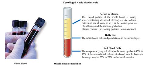 Centrifuged Whole Blood Sample University Medical And Forensic