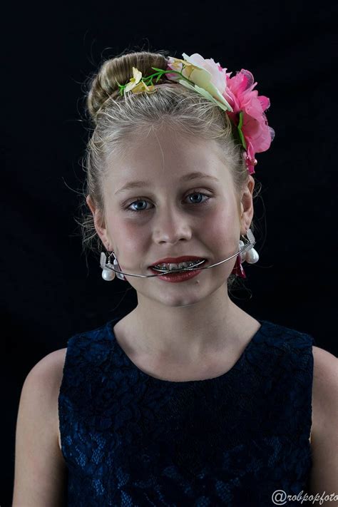 Braces Girlswithbraces Metalbraces Headgear Teeth Braces Dental