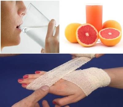 Yes, burn scars are difficult to get rid of and it stays as a constant reminder of the painful accident. How to Get Rid of Burn Scars