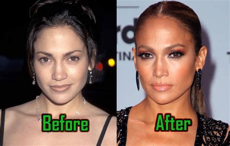Jennifer Lopez Plastic Surgery Nose Job Boob Job Before After