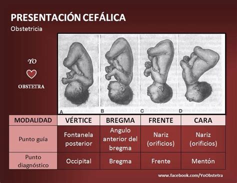Presentación cefalicA Obstetricia Obstetricia y puericultura Medicina